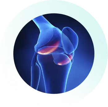 Knee_Specialist_Services_ACL_Osteoarthritis Knee_Specialist_Services_ACL_Osteoarthritis