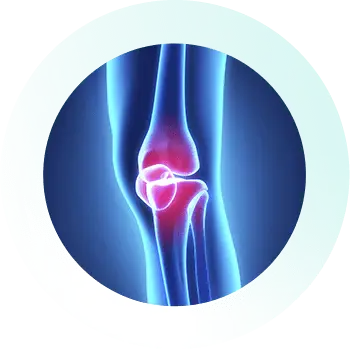 Knee_Specialist_Services_Loose-Bodies Knee_Specialist_Services_Loose-Bodies