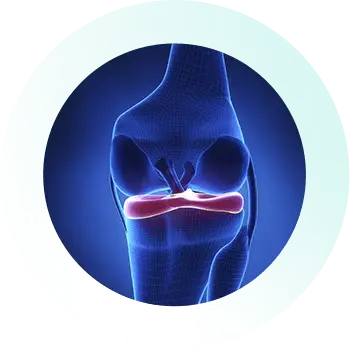 Knee_Specialist_Services_Meniscus Knee_Specialist_Services_Meniscus