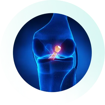 Knee_Specialist_Services_PCL Knee_Specialist_Services_PCL