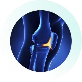Knee_Specialist_Services_Patellar-Tendinitis Knee_Specialist_Services_Patellar-Tendinitis