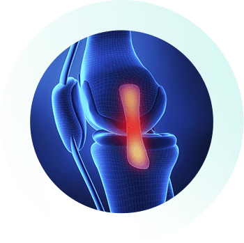 Knee_Specialist_Services_Quadriceps-Tendon-Injury Knee_Specialist_Services_Quadriceps-Tendon-Injury